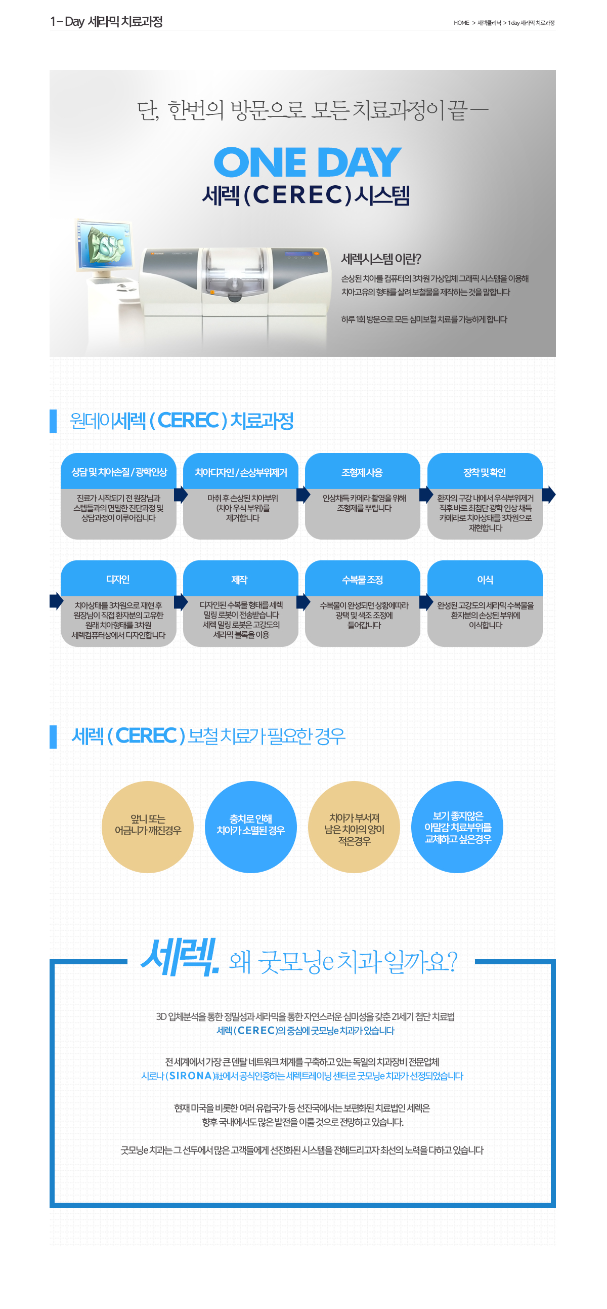 세렉 시술과정